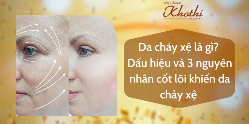 Da chảy xệ là gì? Dấu hiệu và 3 nguyên nhân cốt lõi khiến da chảy xệ