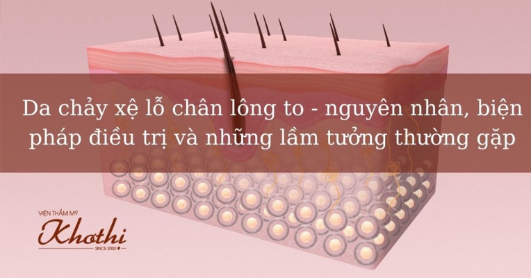 da chảy xệ lỗ chân lông to