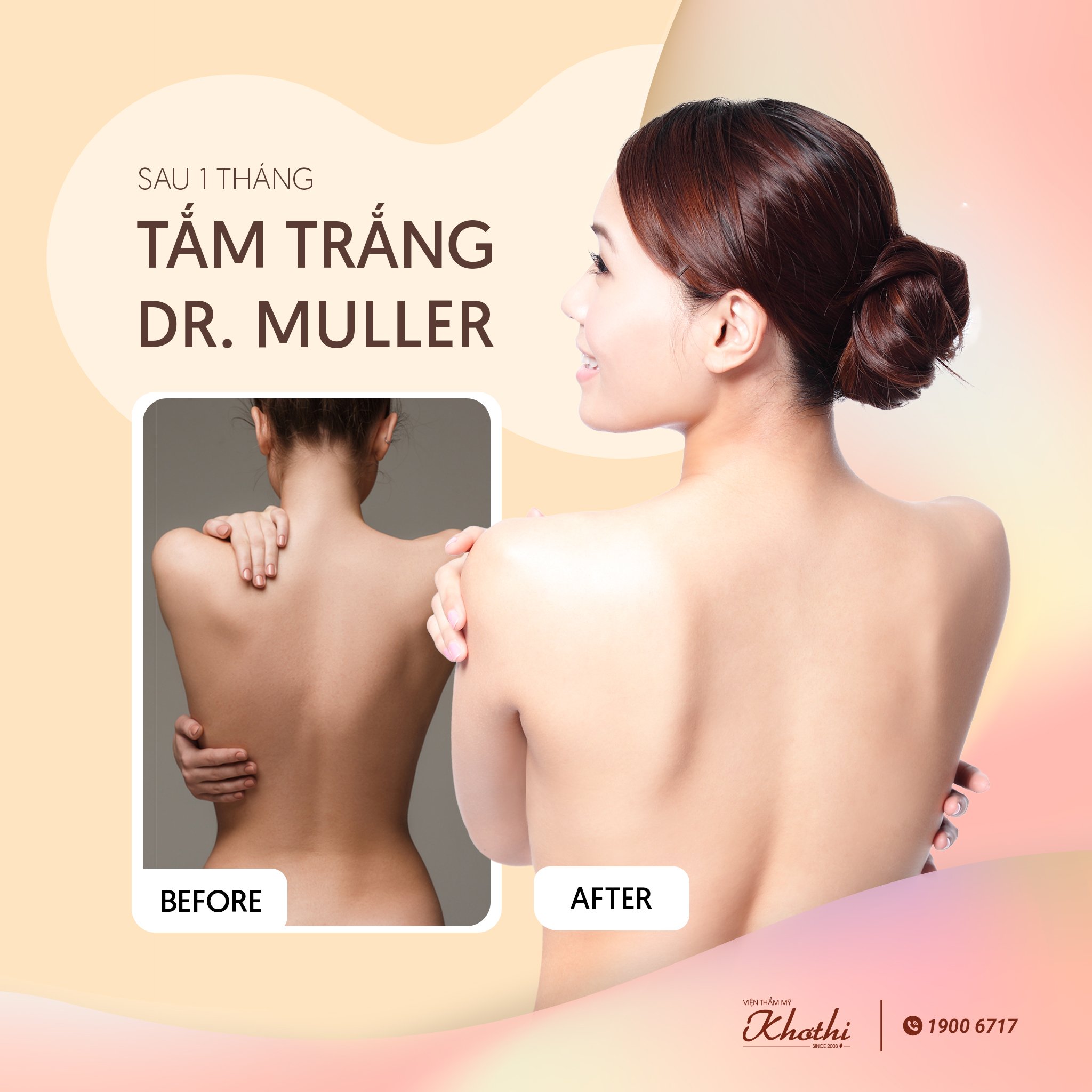 Tắm trắng da toàn thân DR Muller trắng bật tone nhanh chóng và an toàn