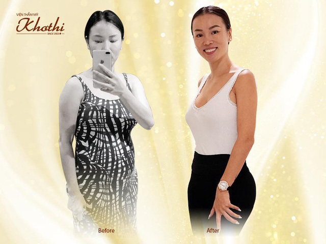 Miko Diet - Giảm mỡ bắp tay an toàn và hiệu quả